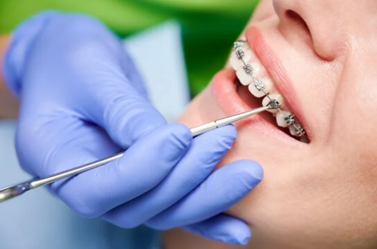 Orthodontics-